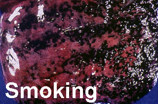 smoklng.jpg (35490 bytes)
