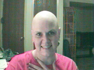 Bald.jpg (11631 bytes)