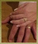 The Rings