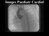 Aortogram
