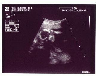 First Photo