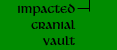 Impacted Cranial Vault