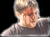 biocrack.gif (6429 bytes)
