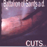 Cuts