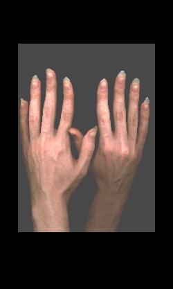 hands