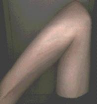 elbow