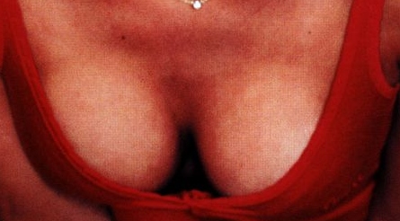 Denise Van Outen