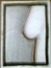 Breast
