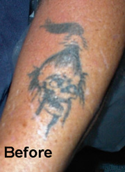 See, I told you it woun't HURT to bad!!!