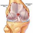 Arthritis Herbs Treatment CureArthritis Herbs Treatment CureArthritis Herbs Treatment Cure