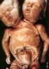 2 babys