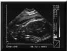 Sonogram080802_1.jpg (23262 bytes)