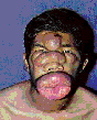 Fat Lips