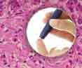 Diabetes Herbal Herbs Medicine Treatment Cure KL Kuala Lumpur, Diabetic Cure Herbs