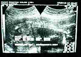 Ultrascan E