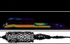 Sonogram (41 KB)