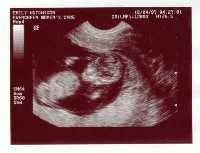 baby.jpg (5011 bytes)