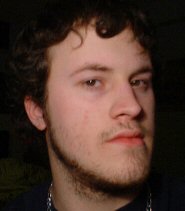 look! I have a zit on this side
