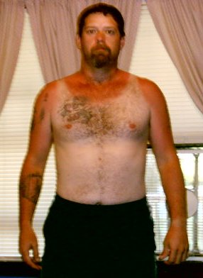 The only other thing I caught besides a catfish was this sunburn