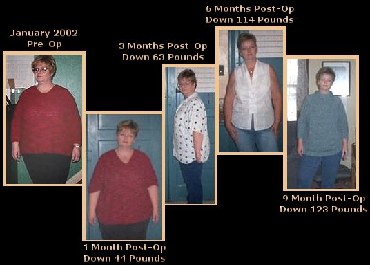 Weight Pictures