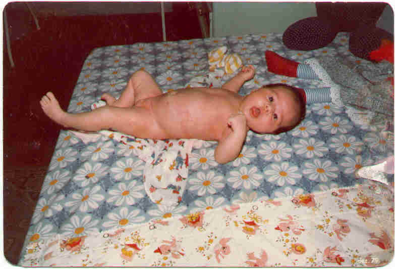 Eu peladona P/ vcs rs