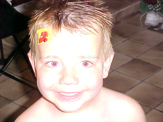 Cute even with a boo boo!