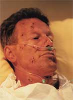 A man with the virus