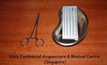 Acupuncture needles