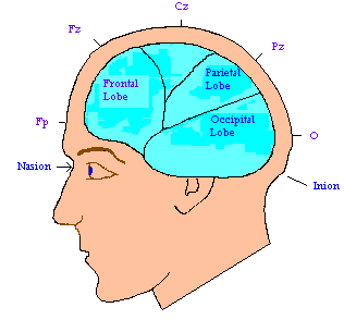 electrodes