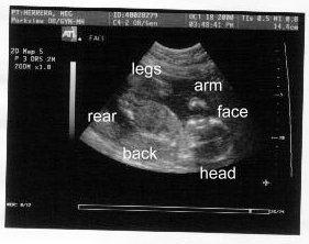 {short description of image}