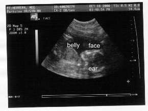 {short description of image}