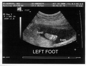 {short description of image}