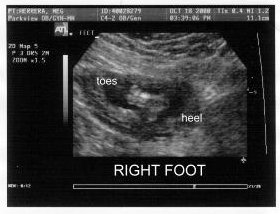 {short description of image}