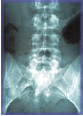 X-Ray