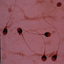 Something pink. SPERM! SPERM!  FUCKIN' SPERM!