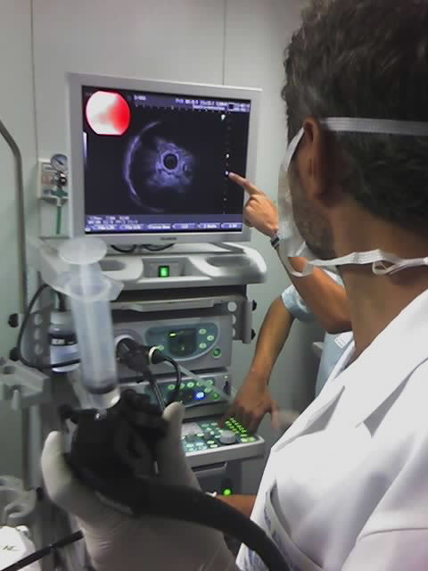 UFMG-ultrasom Fujinon SU-7000