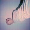Unbuttoned Sleeve 1