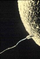 Conception - Rotated 90 Degrees Left