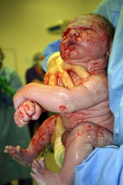 Bloody Baby