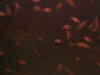 lhbpfries23days.JPG (20843 bytes)