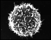 SEM Shapes of Lymphocytes