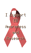 EB