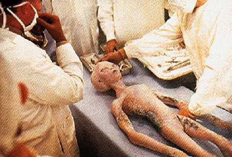 Alien Autopsy