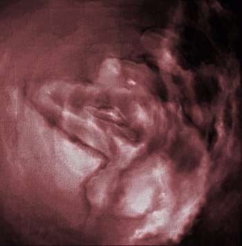 Bloody Venus